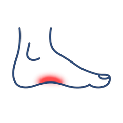 Flat Feet