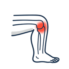 Knee Pain