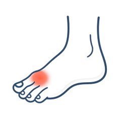 Gout