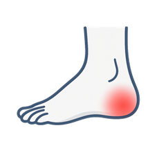 Heel Spurs