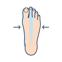 Narrow Feet